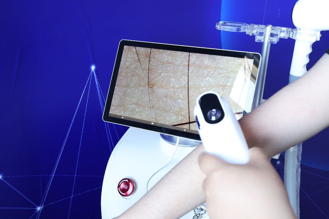 DIODE LASER ICE ALPHA PRO 4WAVE alpha-pro-ice-diode-laser-ontharingsapparaat-veilige-effectieve-ontharing-camera-huid-en-haar-analyse